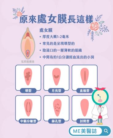 破解處女膜迷思！誰說女生第一次親密接觸下體會出血？