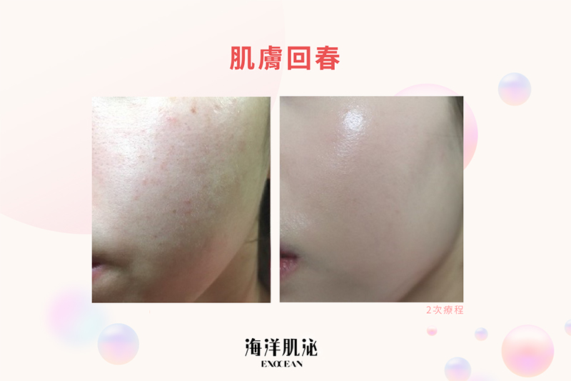 外泌體, 美人魚時尚婦產科診所, 私密處乾澀, 禿頭, 郭安妮, 高潮, 性生活