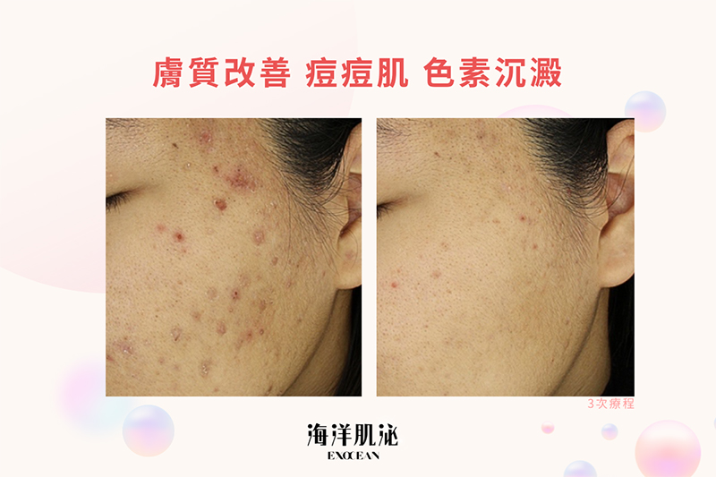 外泌體, 美人魚時尚婦產科診所, 私密處乾澀, 禿頭, 郭安妮, 高潮, 性生活